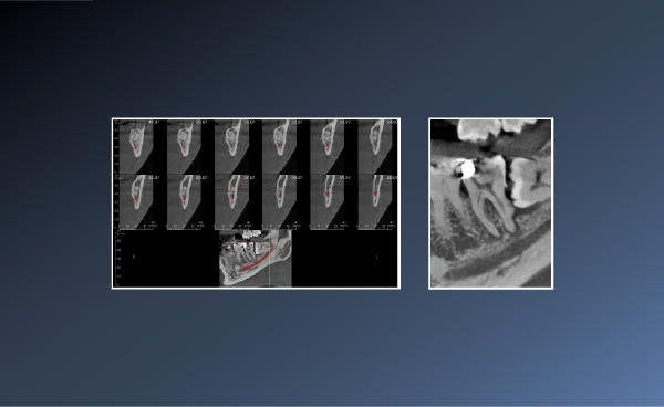Did this Patient Require a CBCT? – 24th Jan&hellip;