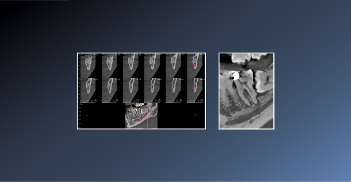 Did this Patient Require a CBCT? – 24th Jan 2022