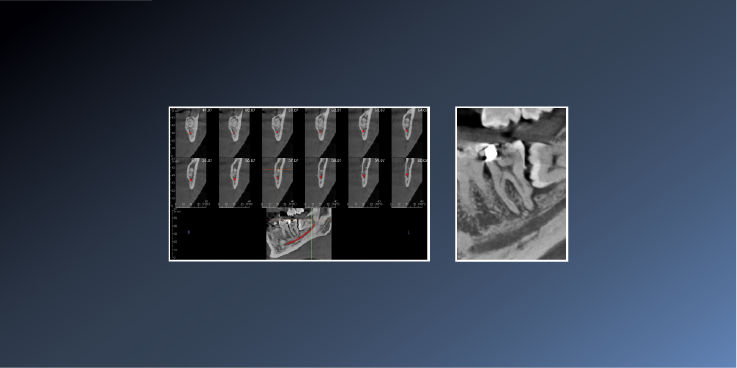 Did this Patient Require a CBCT? – January 24,&hellip;