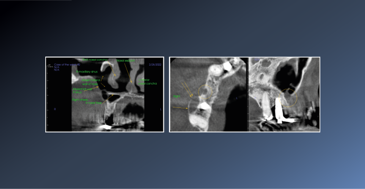 The Importance of Providing Medical and Dental Histories – 22nd Mar 2022