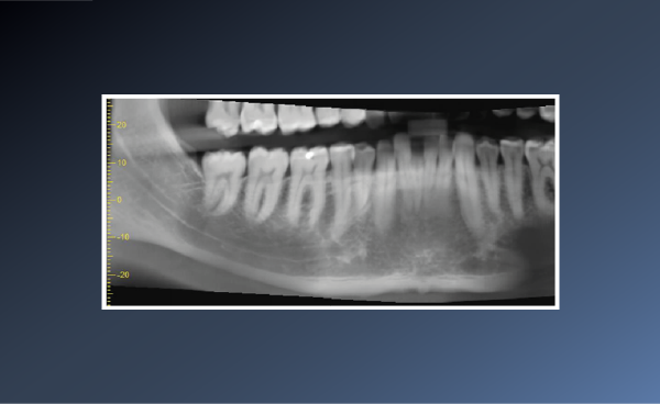 What does Prof.Horner think about this case? – August&hellip;