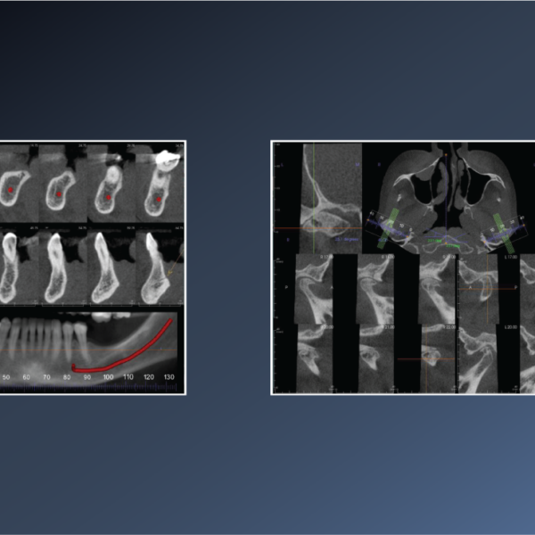 ???? Degenerative Joint Disease – November 02, 2022