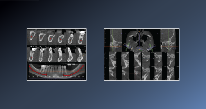 ???? Degenerative Joint Disease – November 02, 2022
