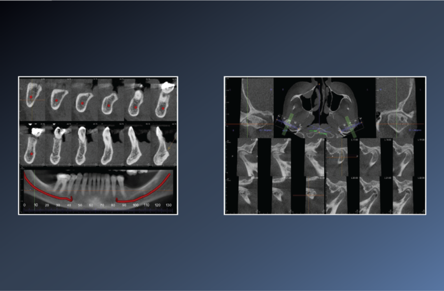 ???? Degenerative Joint Disease – November 02, 2022