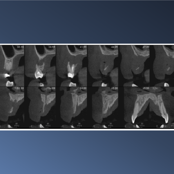 A Floating Tooth – February 17, 2023