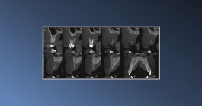 A Floating Tooth – February 17, 2023