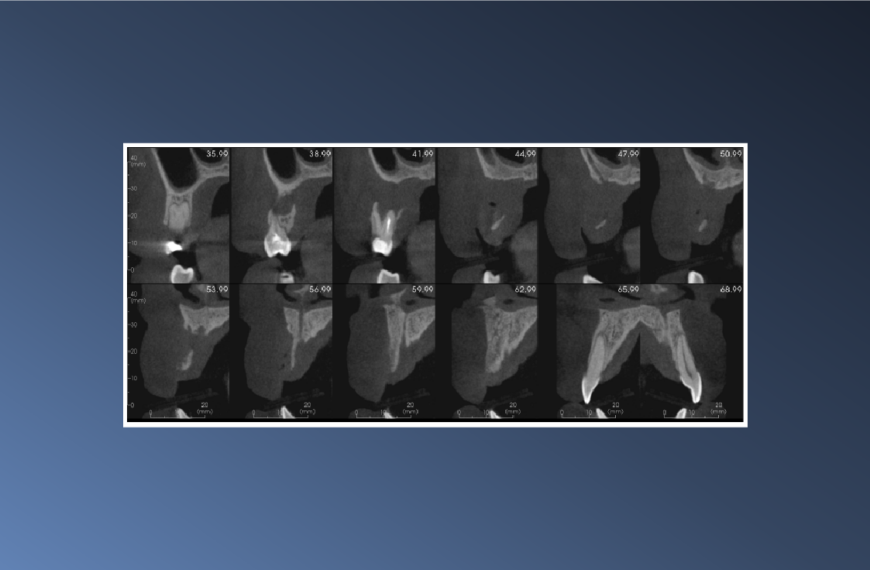 A Floating Tooth – February 17, 2023