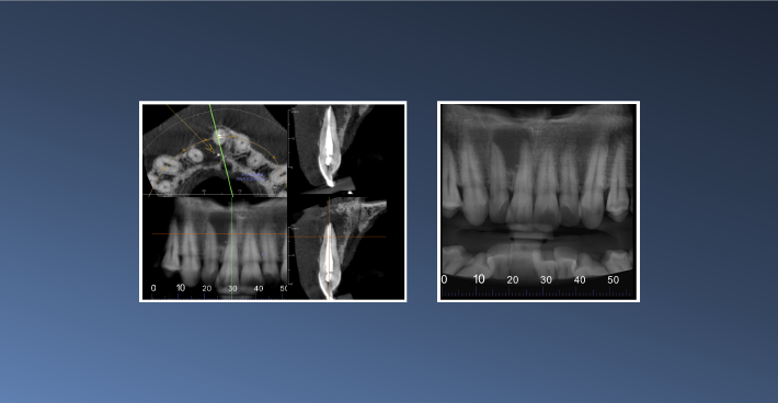 Have you ever seen a 12mm cyst before? – July 08, 2022