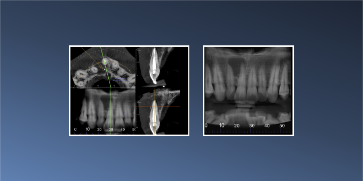 Have you ever seen a 12mm cyst before? –&hellip;