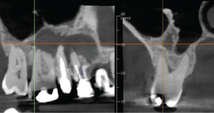 A Reactionary Bone Formation – April 26, 2023