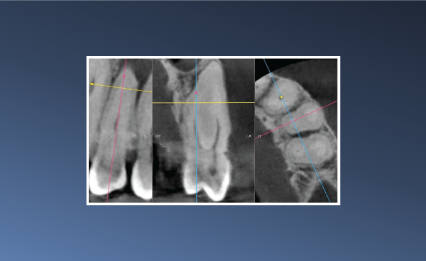 An Unusual Radiolucency – June 19, 2023