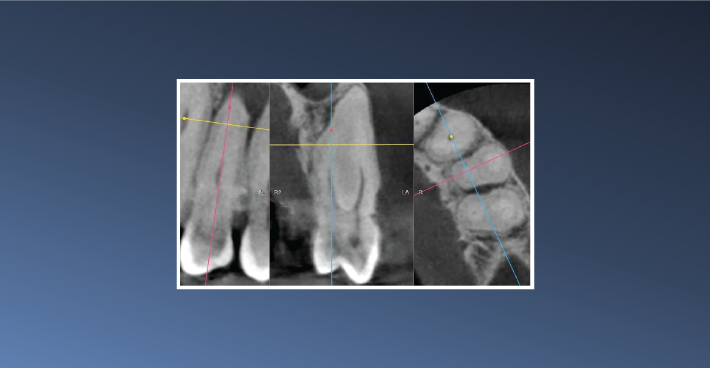 An Unusual Radiolucency – June 19, 2023
