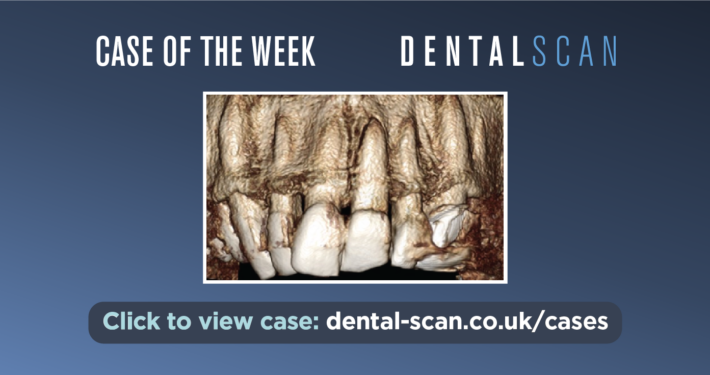 A Punch in the Face – July 6, 2023