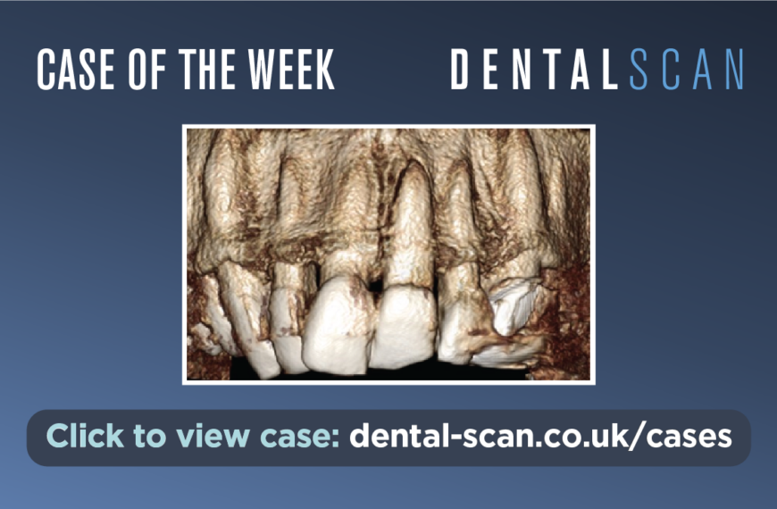 A Punch in the Face – July 6, 2023