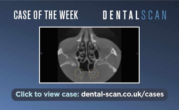 Case of the Week – Ticking time bomb