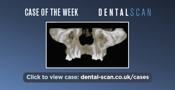 Case Of The Week – ????‍⚕️ Review by ENT Recommended!