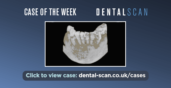 Case Of The Week – ???? Four Lesions Combine&hellip;