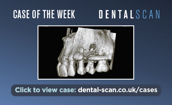 Case Of The Week – The Double Crown – March 11, 2024