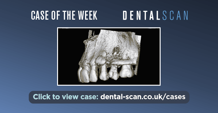 Case Of The Week – The Double Crown – March 11, 2024