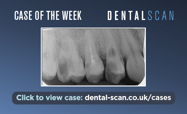 Case Of The Week – Poor Prognosis – March&hellip;