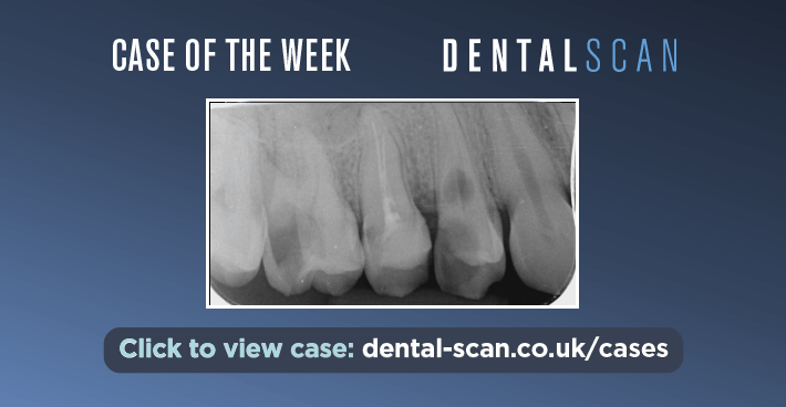Case Of The Week – Poor Prognosis – March 5, 2024