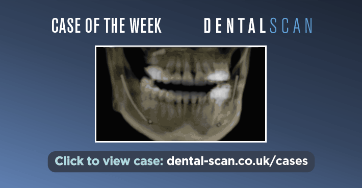 Case Of The Week – Penetrated the IDC or not? – April 2, 2024