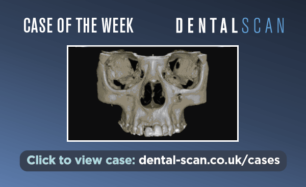 Case Of The Week – Kink in the Tooth!? – June 30, 2024