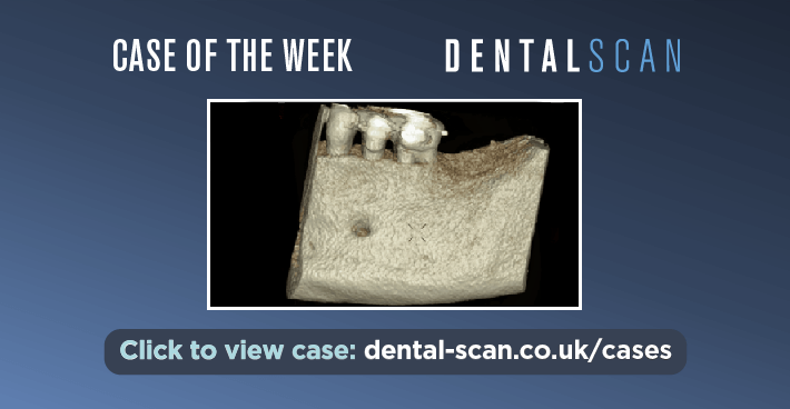 Case Of The Week – Incidental Finding #3 ????