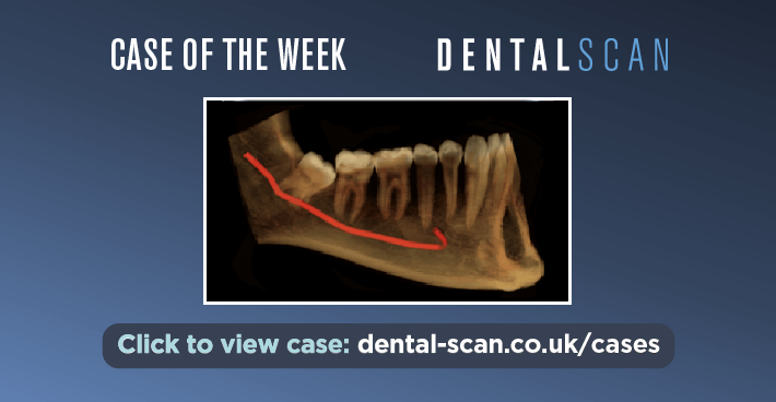 Case Of The Week – Trapped IDC!