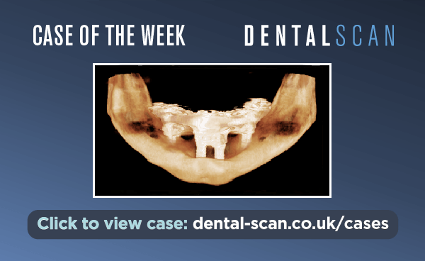 Case of the Week – A Fractured Mandible
