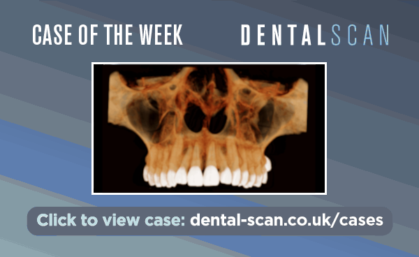 Case Of The Week – An Incidental Finding!
