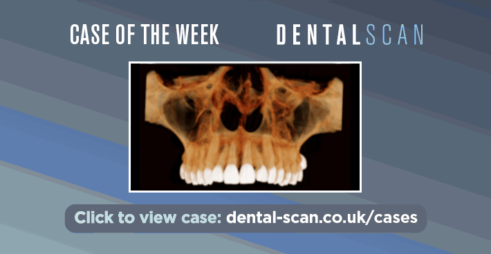 Case Of The Week – An Incidental Finding!