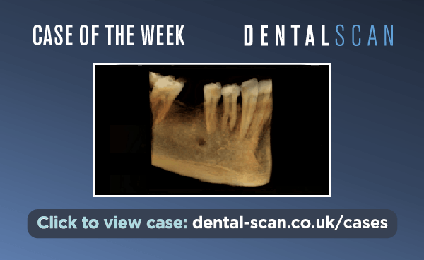 Case of the Week – Trifid Roots on a&hellip;