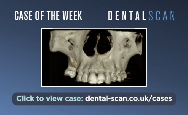 Case of the Week: Unexpected Mass Identified During Routine&hellip;