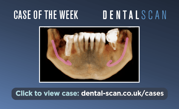 Case Of The Week – Incidental Finding #2!