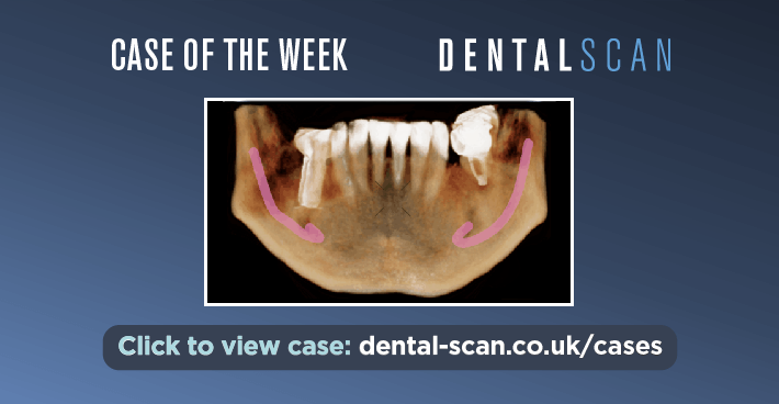Case Of The Week – Incidental Finding #2!